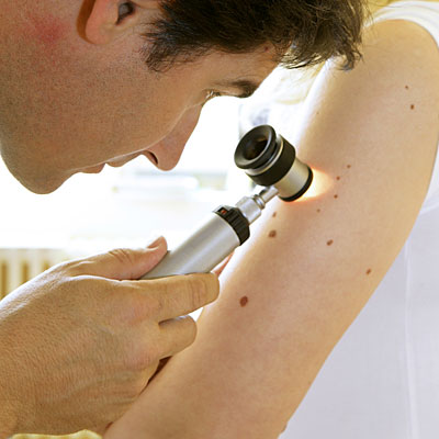 Identifying a skin cancer